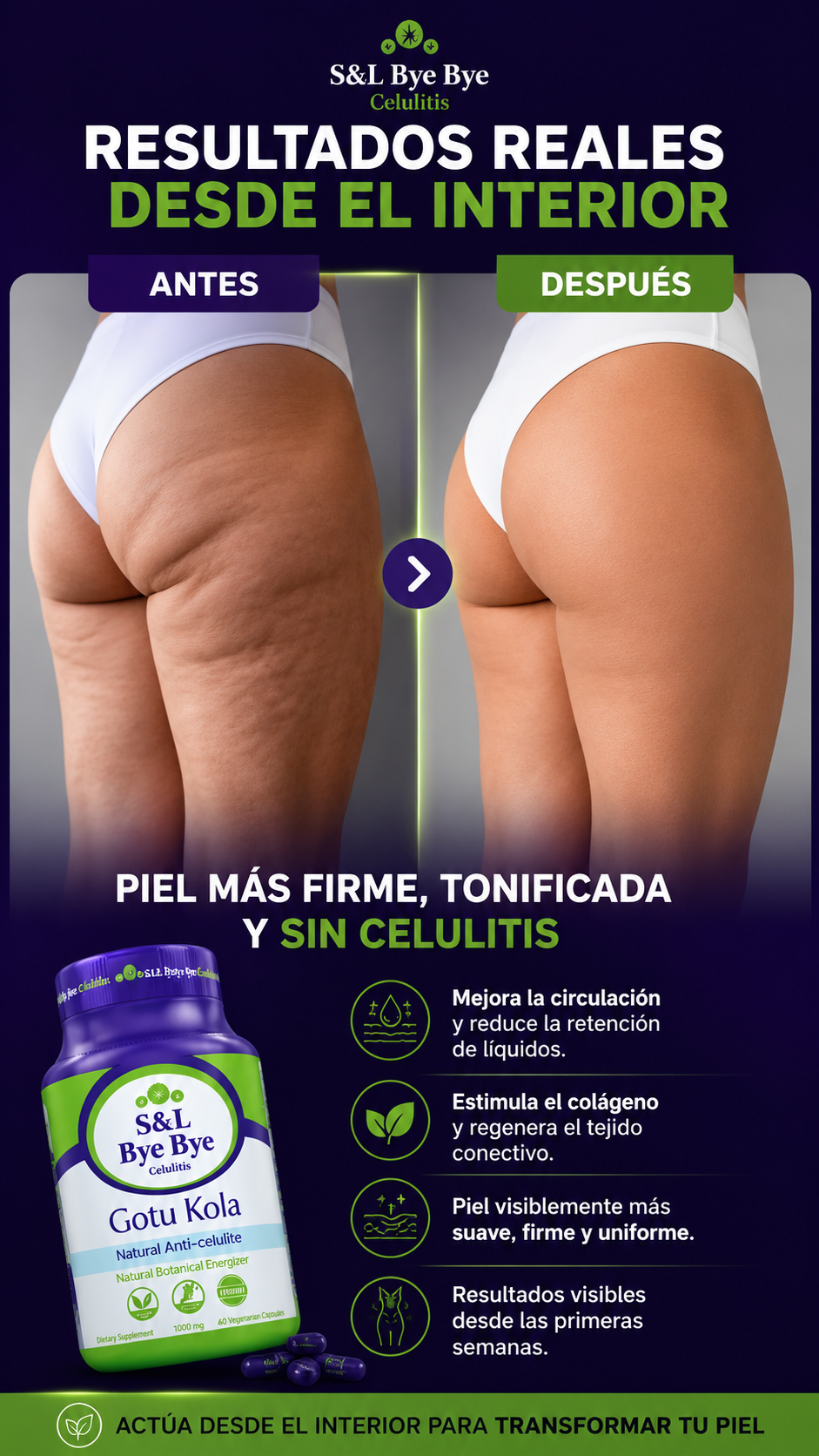 BYE BYE CELULITIS